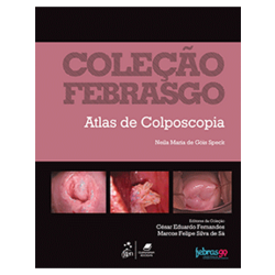 E-book - Coleção Febrasgo - Atlas de Colposcopia
